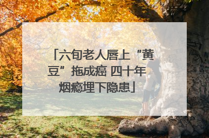 六旬老人唇上“黄豆”拖成癌 四十年烟瘾埋下隐患